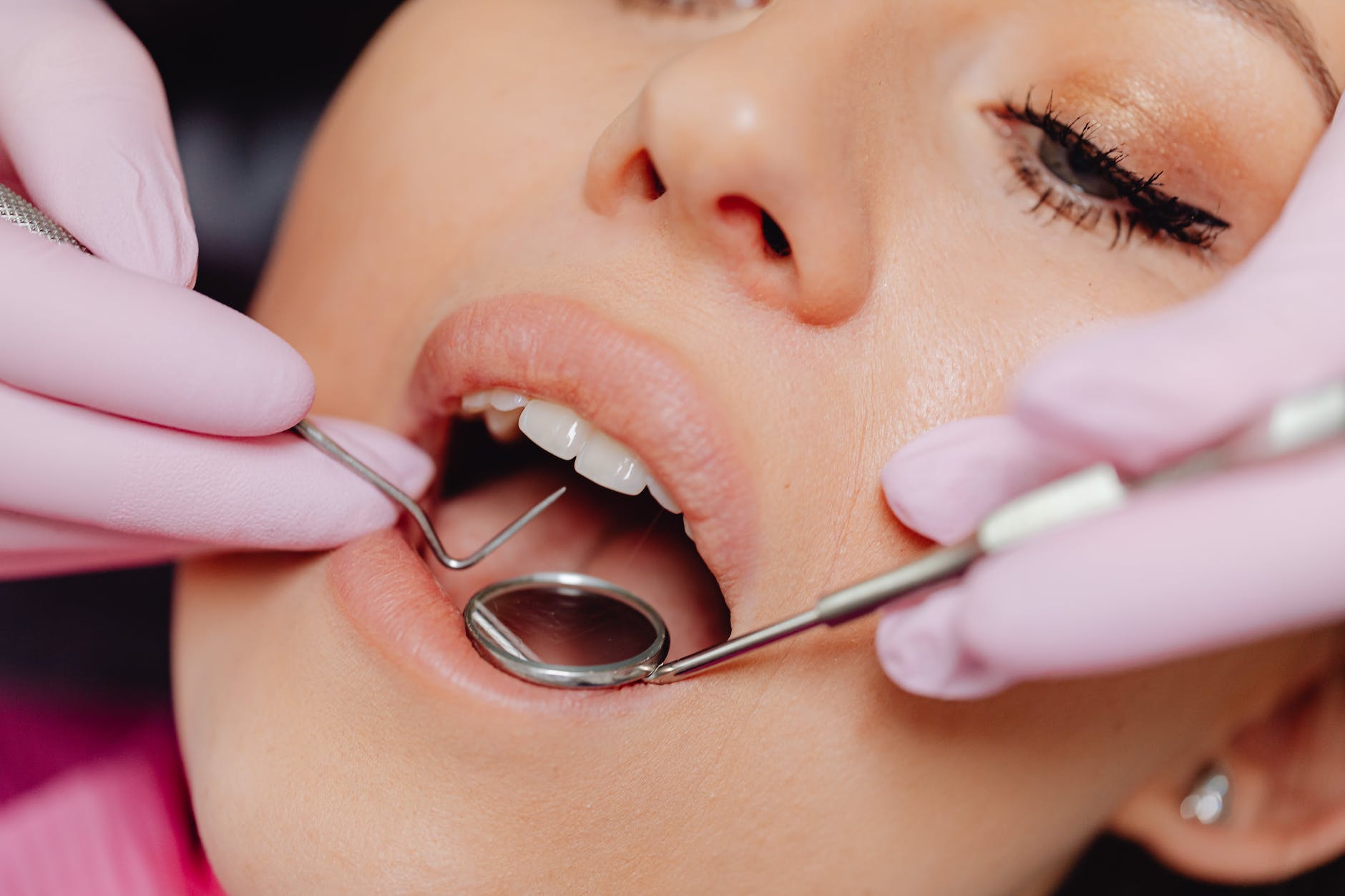 Dental Fillings COSMO DENTAL